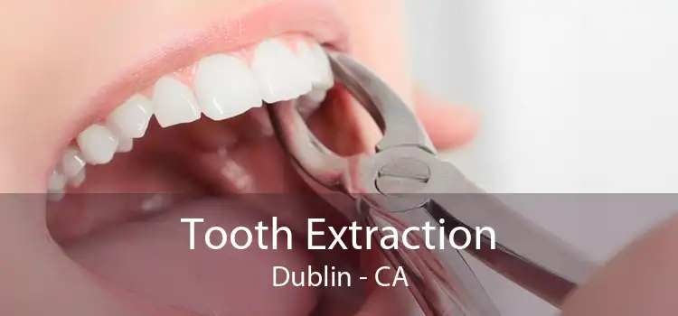 Tooth Extraction Dublin - CA