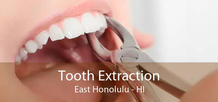 Tooth Extraction East Honolulu - HI