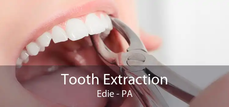 Tooth Extraction Edie - PA