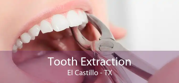 Tooth Extraction El Castillo - TX