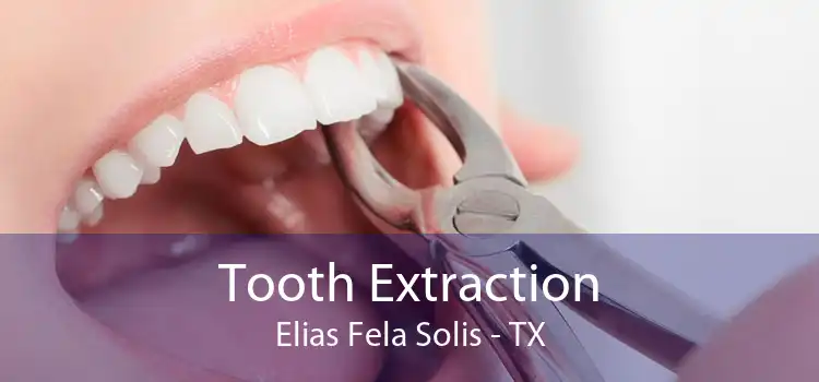 Tooth Extraction Elias Fela Solis - TX