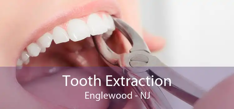 Tooth Extraction Englewood - NJ