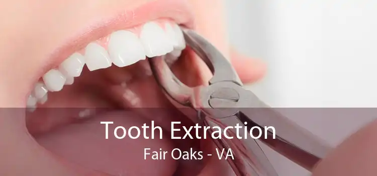 Tooth Extraction Fair Oaks - VA