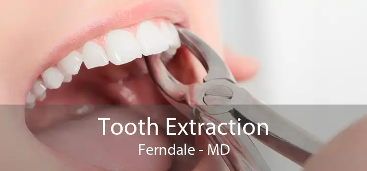 Tooth Extraction Ferndale - MD