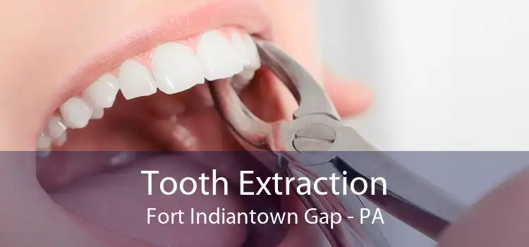 Tooth Extraction Fort Indiantown Gap - PA