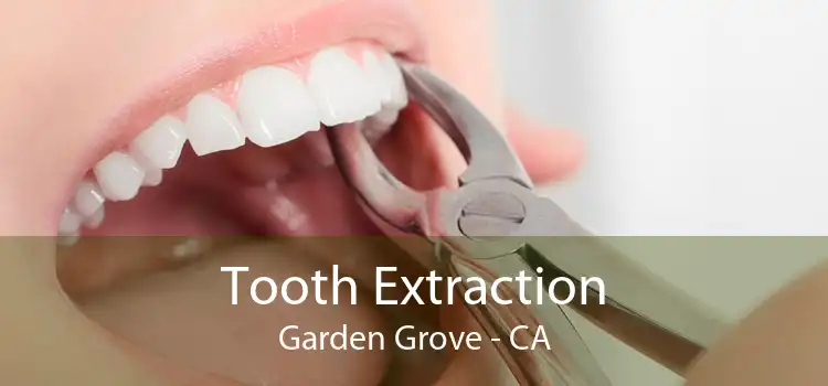 Tooth Extraction Garden Grove - CA