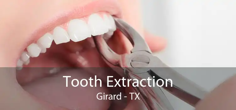 Tooth Extraction Girard - TX