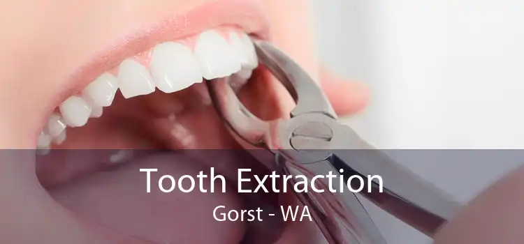 Tooth Extraction Gorst - WA
