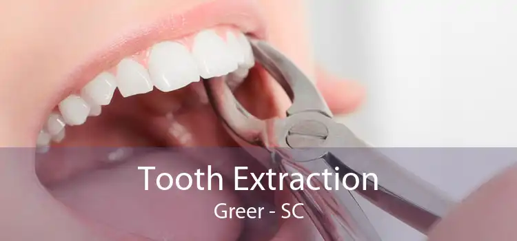 Tooth Extraction Greer - SC