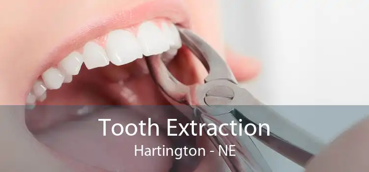 Tooth Extraction Hartington - NE