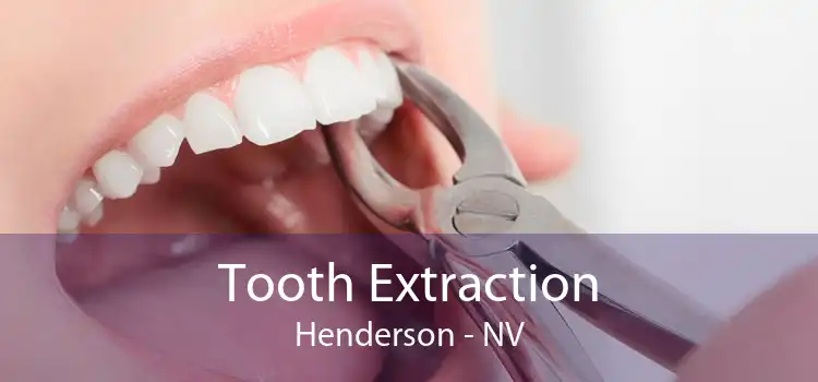 Tooth Extraction Henderson - NV