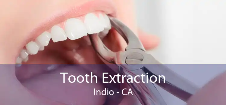 Tooth Extraction Indio - CA