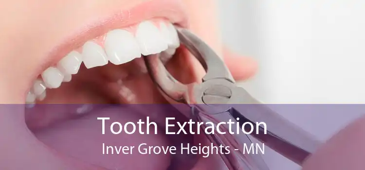 Tooth Extraction Inver Grove Heights - MN