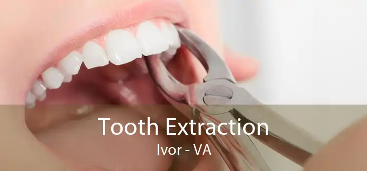 Tooth Extraction Ivor - VA