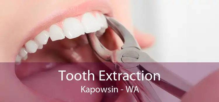 Tooth Extraction Kapowsin - WA