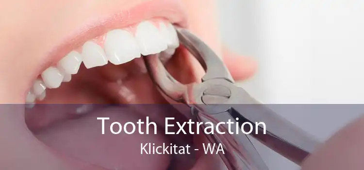 Tooth Extraction Klickitat - WA