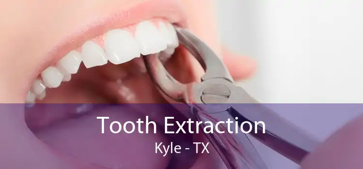 Tooth Extraction Kyle - TX