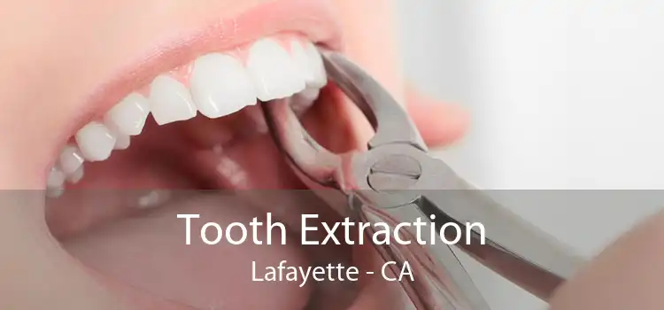 Tooth Extraction Lafayette - CA