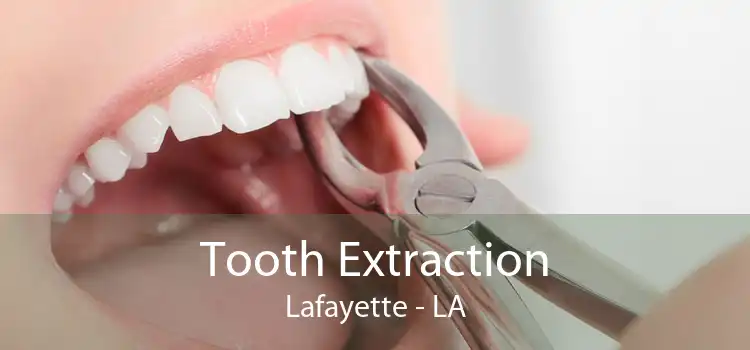 Tooth Extraction Lafayette - LA