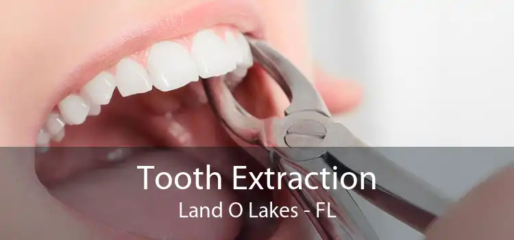 Tooth Extraction Land O Lakes - FL