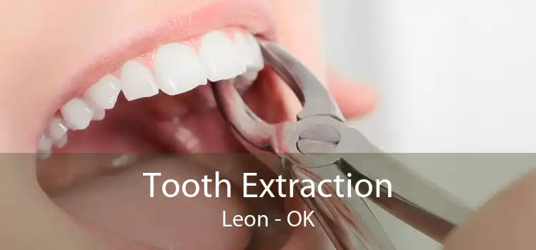 Tooth Extraction Leon - OK