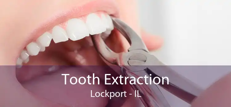 Tooth Extraction Lockport - IL