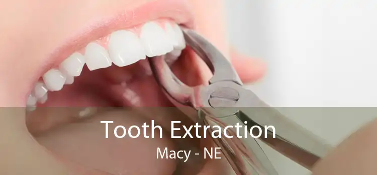 Tooth Extraction Macy - NE