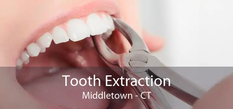 Tooth Extraction Middletown - CT