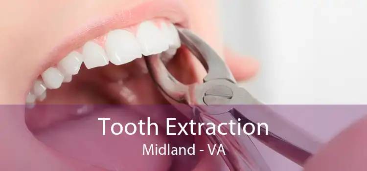 Tooth Extraction Midland - VA