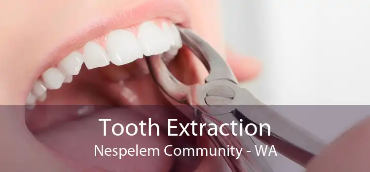 Tooth Extraction Nespelem Community - WA