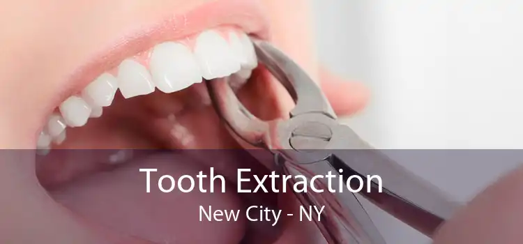 Tooth Extraction New City - NY
