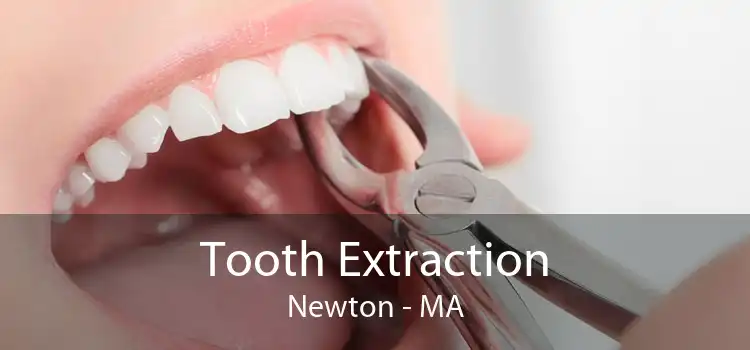 Tooth Extraction Newton - MA