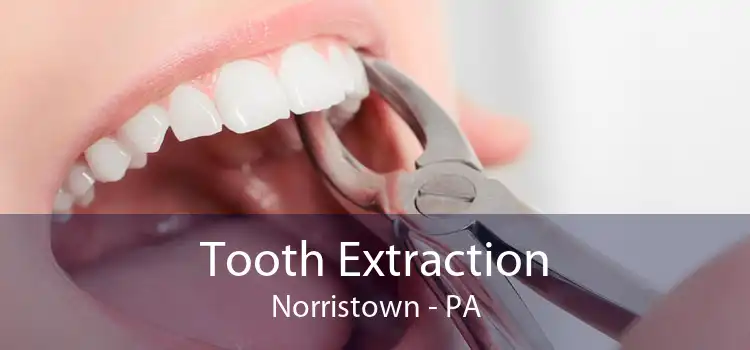 Tooth Extraction Norristown - PA
