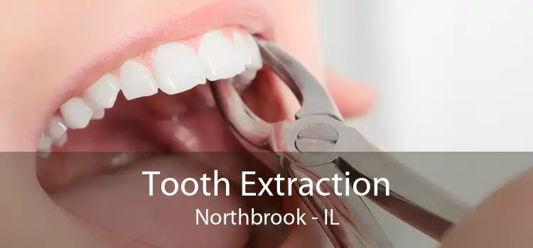 Tooth Extraction Northbrook - IL