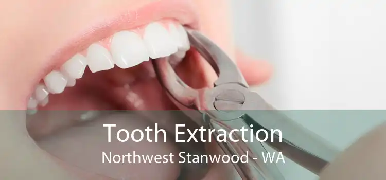 Tooth Extraction Northwest Stanwood - WA