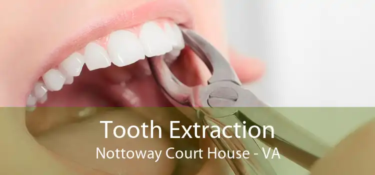 Tooth Extraction Nottoway Court House - VA