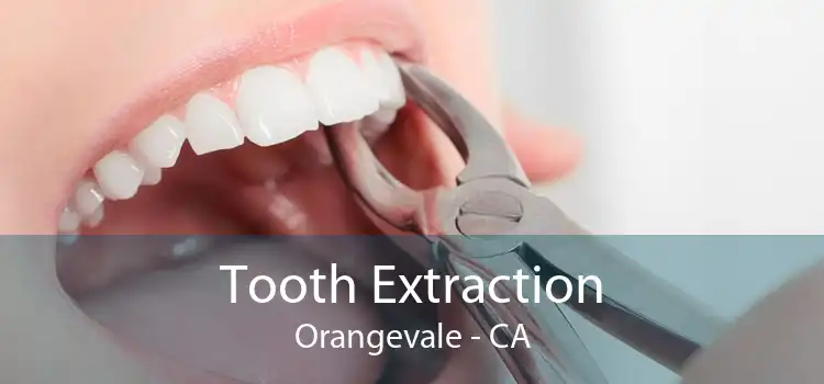 Tooth Extraction Orangevale - CA