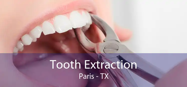 Tooth Extraction Paris - TX