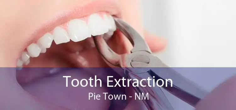 Tooth Extraction Pie Town - NM
