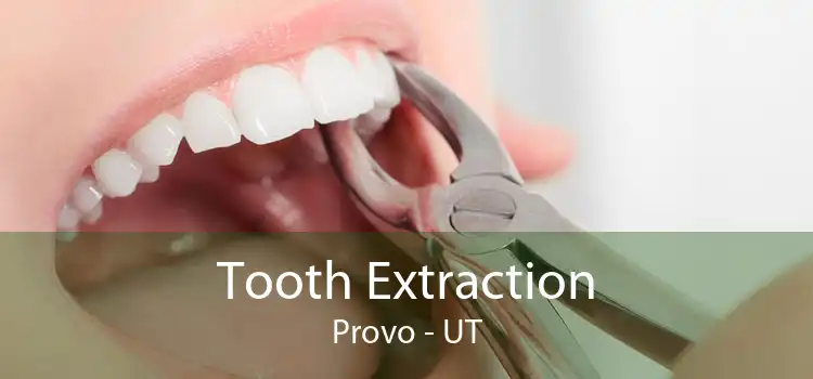 Tooth Extraction Provo - UT