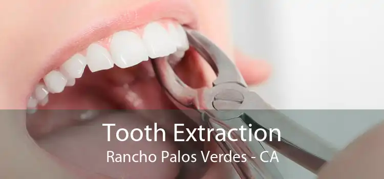 Tooth Extraction Rancho Palos Verdes - CA