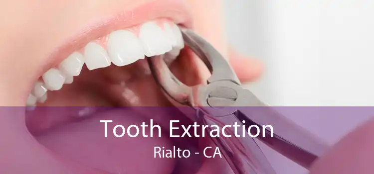 Tooth Extraction Rialto - CA