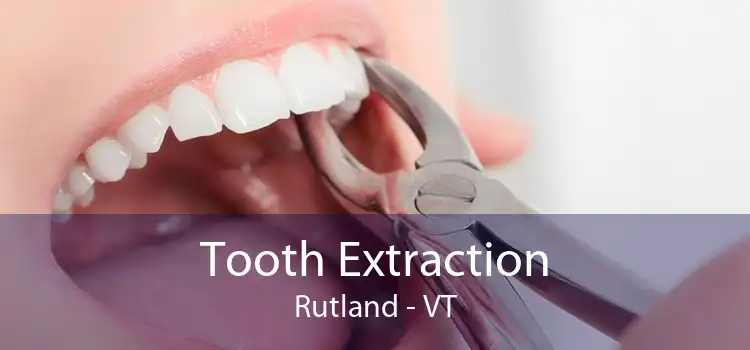 Tooth Extraction Rutland - VT