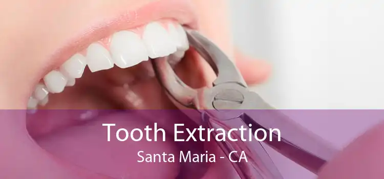Tooth Extraction Santa Maria - CA