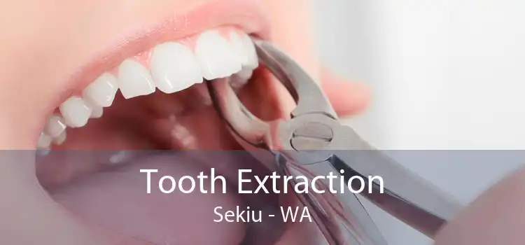 Tooth Extraction Sekiu - WA