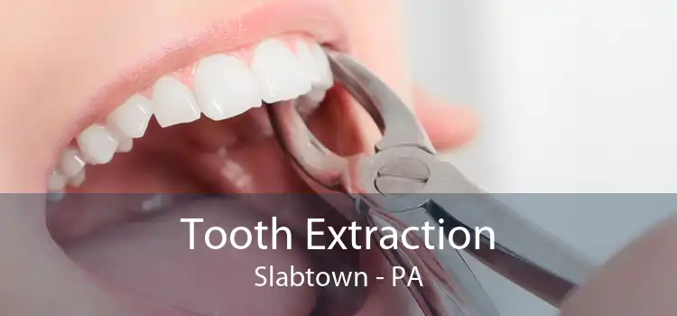 Tooth Extraction Slabtown - PA