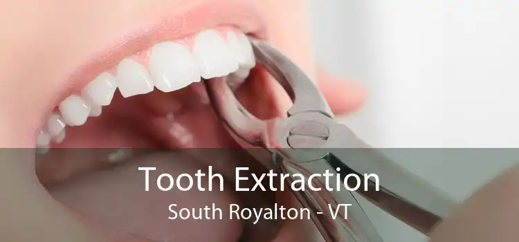 Tooth Extraction South Royalton - VT