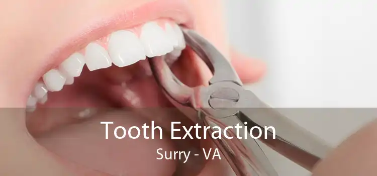 Tooth Extraction Surry - VA