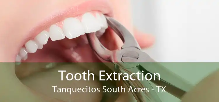 Tooth Extraction Tanquecitos South Acres - TX