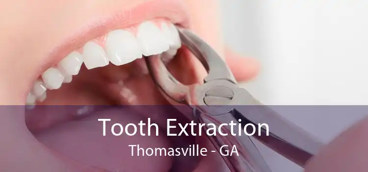 Tooth Extraction Thomasville - GA